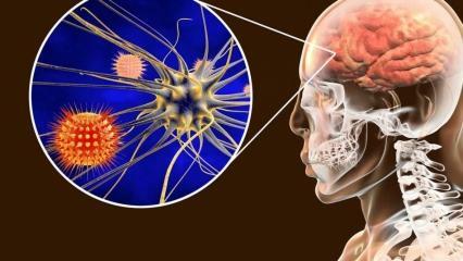 Hvad er meningitis, og hvad er dens symptomer? Er der en behandling for meningitis?